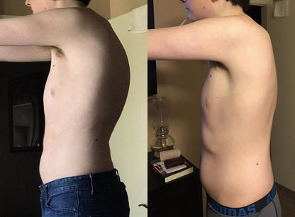 Instant Posture Corrector